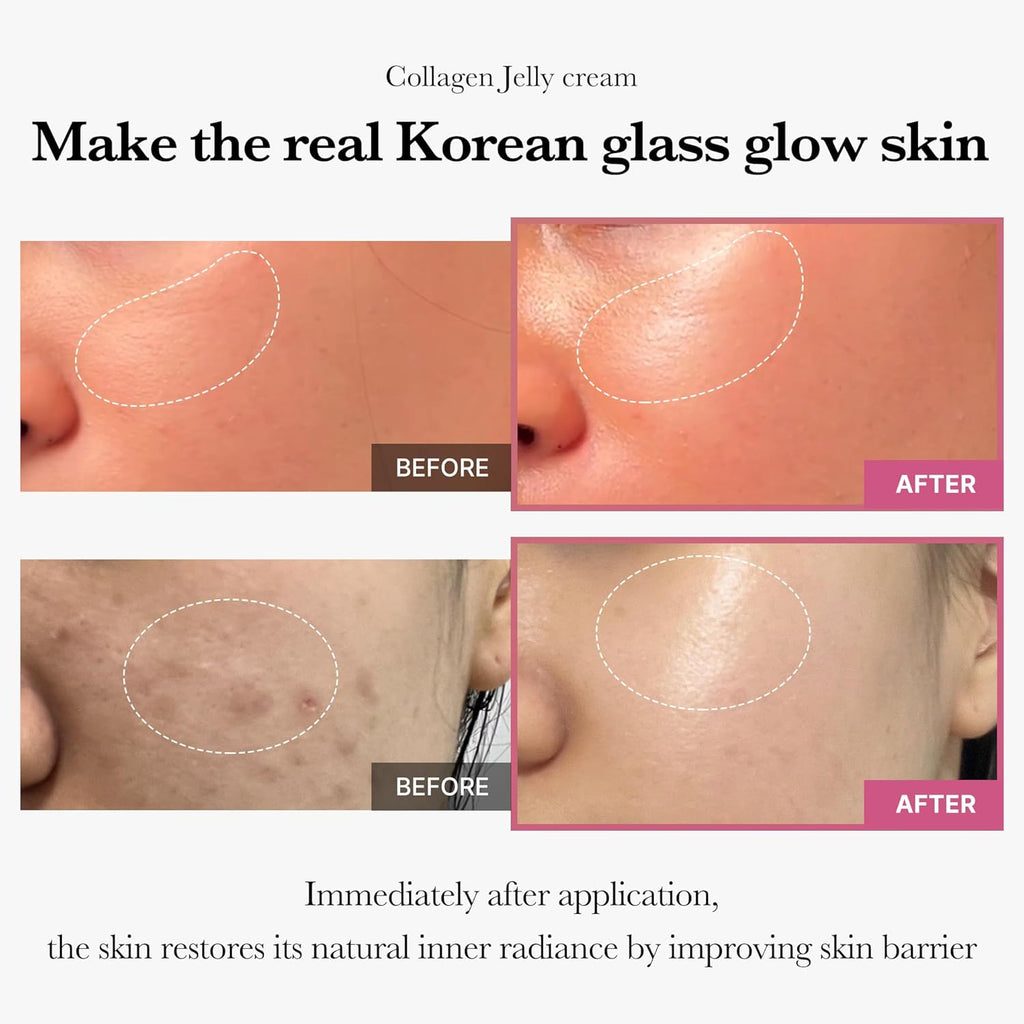 Collagen Glass Skin Duo: Age-R Booster Pro Black and Collagen Jelly Cream 110Ml (3.71 Fl.Oz) | for Radiant and Firmer-Looking Glow | At-Home Care